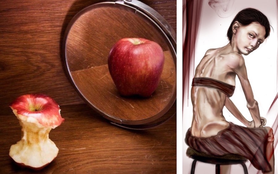 Acerca de la anorexia