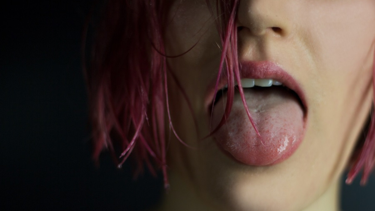 Síndrome de Rapunzel