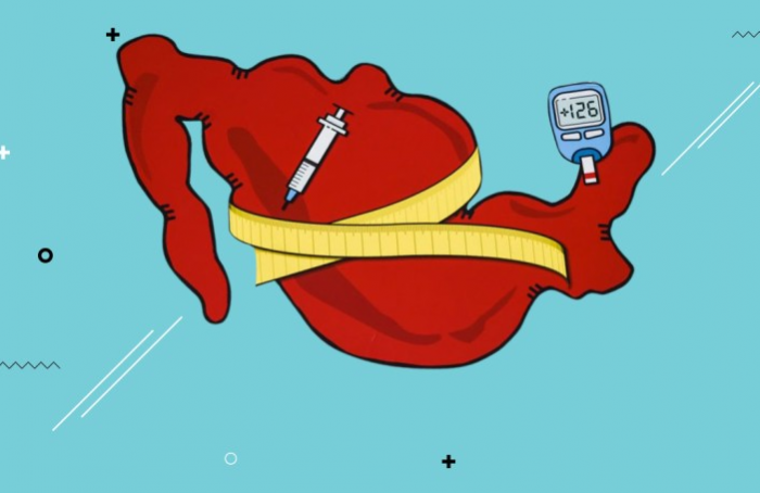 Obesidad y covid-19: la combinación que mata a México