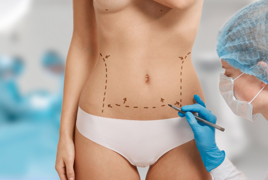 Adicción a la cirugía plástica: un mínimo defecto y al quirófano