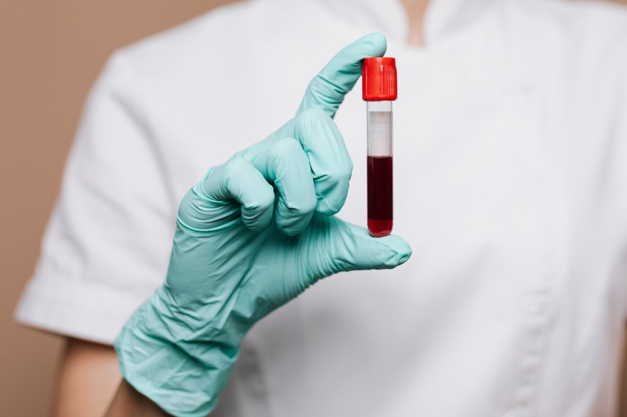 TRASTORNOS HEMODINÁMICOS: EDEMA